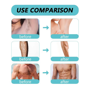 Ecrin - Hair Removal Spray For Men and Women | 100% Original Quick Hair Removal Spray